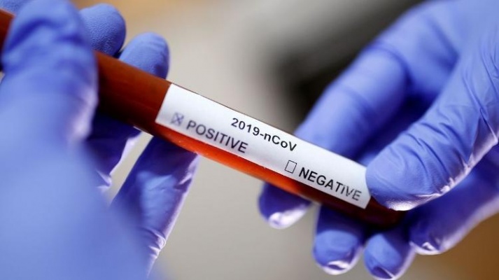 Covid: Paraíba registra 45 novos casos nesta quarta-feira; cinco pessoas morreram