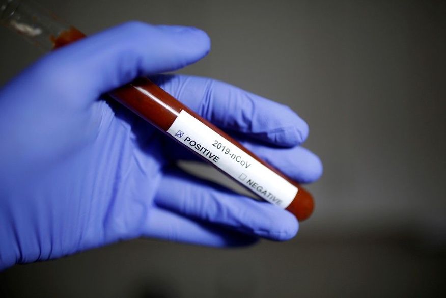 Paraíba registra 8 mortes, 120 novos casos e mais de 2,3 milhões de paraibanos já receberam pelo menos uma dose da vacina